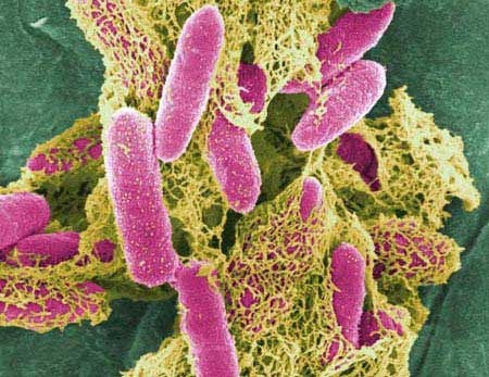 Ph&acirc;n biệt men vi sinh v&agrave; men ti&ecirc;u h&oacute;a 3