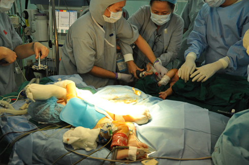 Những cuộc phẫu thuật tách 2 bé song sinh dính liền được ngành y tế Việt Nam thực hiện khá thuần thục. Ảnh: VNE