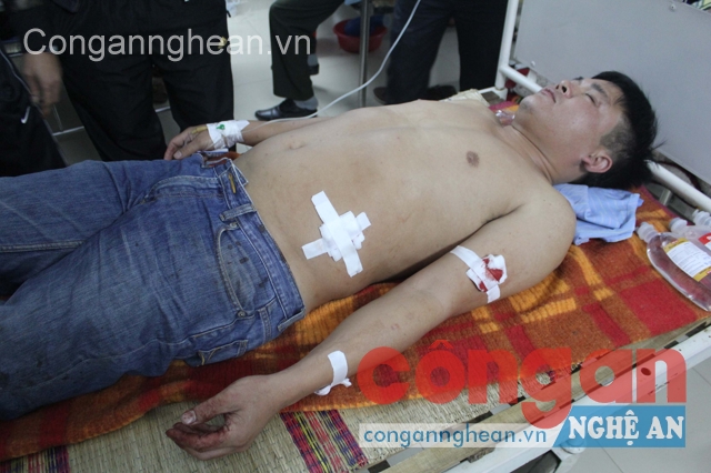 Anh Nguyễn Văn Thành  với vết thương sau vụ nổ súng