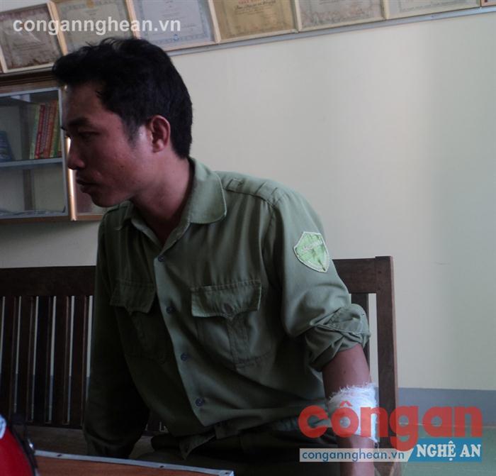 Đồng chí Bùi Văn Đồng, Phó trưởng Công an xã Đồng Hợp bị đối tượng Nghĩa chém vào  cánh tay