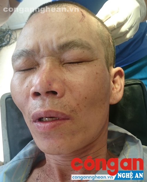 Bị can Hồ Văn Nghinh khi đang điều trị tại bệnh viện