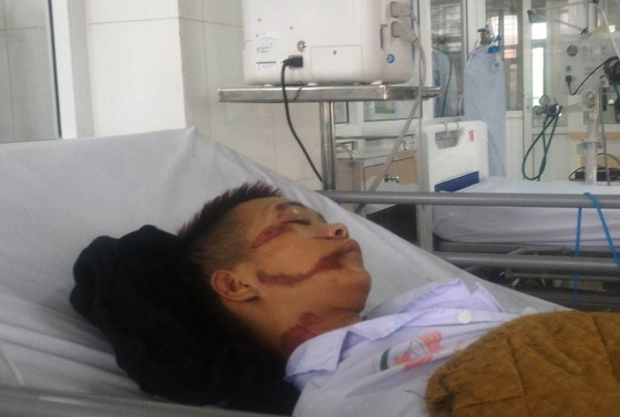 Anh Lê Văn Huy đang được điều trị tại bệnh viện do chấn thương não, vỡ hộp sọ