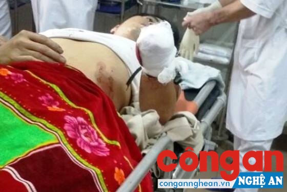 Anh Nguyễn Văn Ngọc đang được điều trị tại Bệnh viện Đa khoa 115