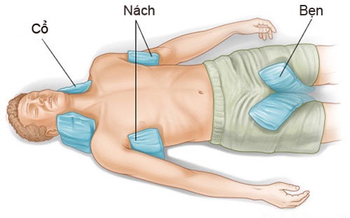 Áp  túi nước đá vào nách, bẹn, cổ và lưng bệnh nhân vị sốc nhiệt để làm giảm nhiệt độ cơ thể
