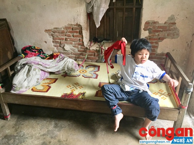 Cháu Trần Thị Như Quỳnh thường xuyên bị bố mẹ trói chân tay để không tự làm đau mình