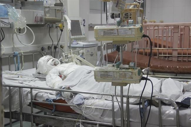 Những bệnh Nhi bị bỏng nặng đang được chăm sóc tại khoa bỏng Bệnh viện Nhi đồng 1 TPHCM.