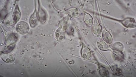 Henneguya salminicola nhìn dưới kính hiển vi 