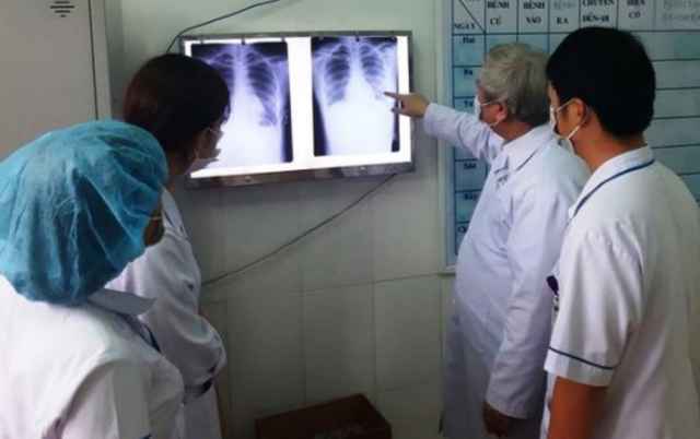 Các bác sĩ phân tích phim XQuang của bệnh nhân nhiễm Covid19. 