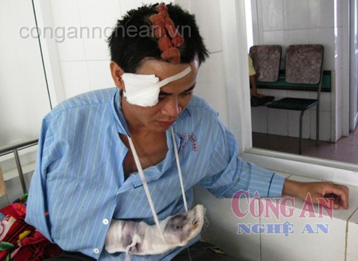 Hành xử lối côn đồ