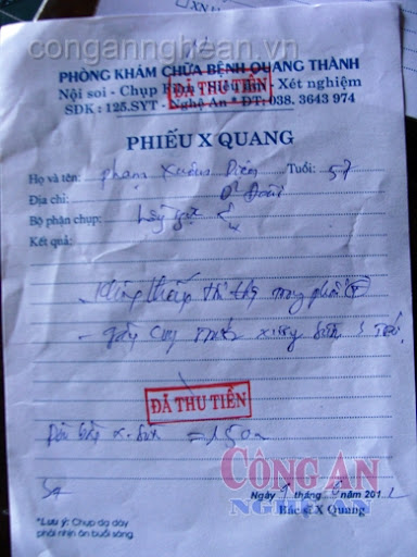 Dân trộm điện, đánh người  của HTX điện năng