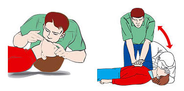 Say nắng, say nóng - Xử trí thế nào? 1