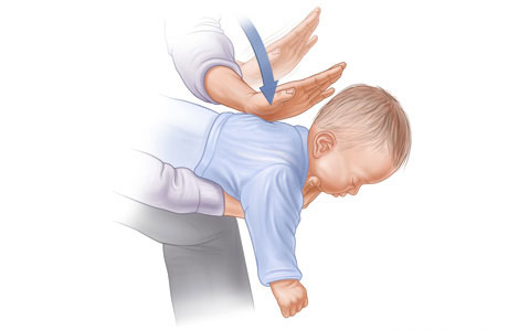 8 kỹ năng cấp cứu cơ bản nên biết