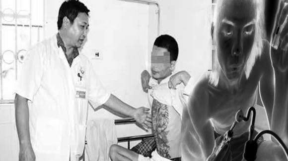 Người nghiện ma túy đá chưa có thuốc điều trị
