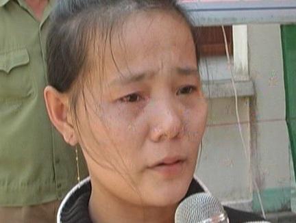 Dùng kéo rạch mặt cháu bé 2 tuổi