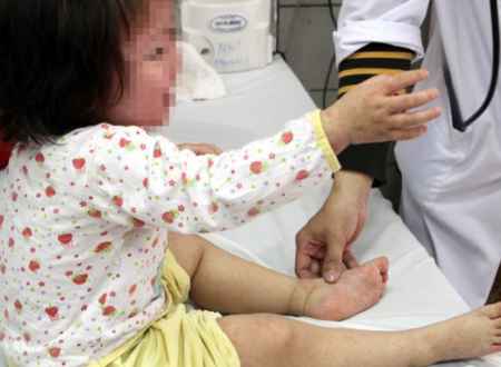 Nhận biết trẻ bị sởi như thế nào?!