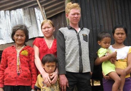 Ăn thịt, uống mật và máu rái cá sinh con giống... Tây