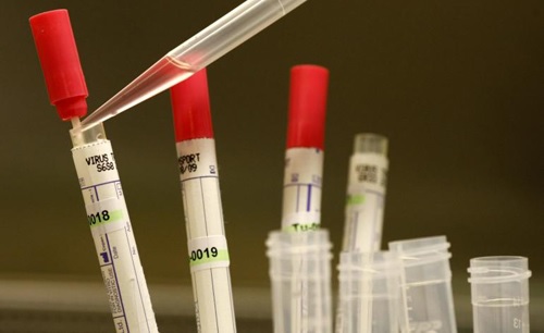 Mỹ sắp thử nghiệm vaccine Ebola trên người