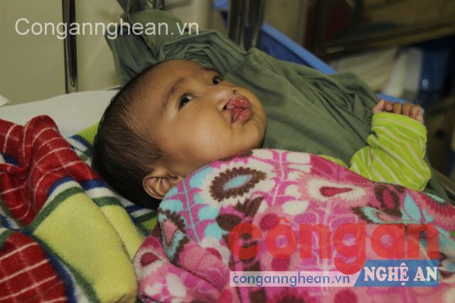 Bé Lương Văn Thiệu rất cần sự giúp đỡ của các nhà hảo tâm