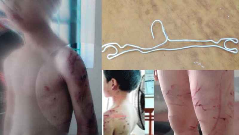 Vụ cha đẻ đánh con: Khởi tố, làm rõ nhiều tình tiết