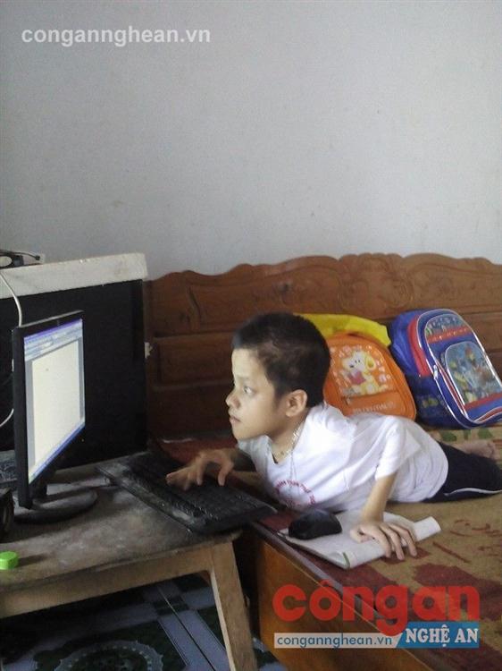 Nghị lực của cậu bé xương thuỷ tinh