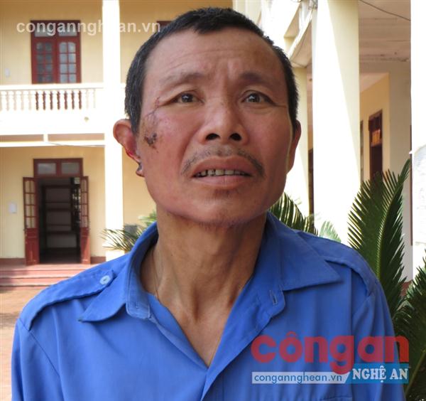 Dùng liềm sát hại hàng xóm lĩnh án 17 năm tù