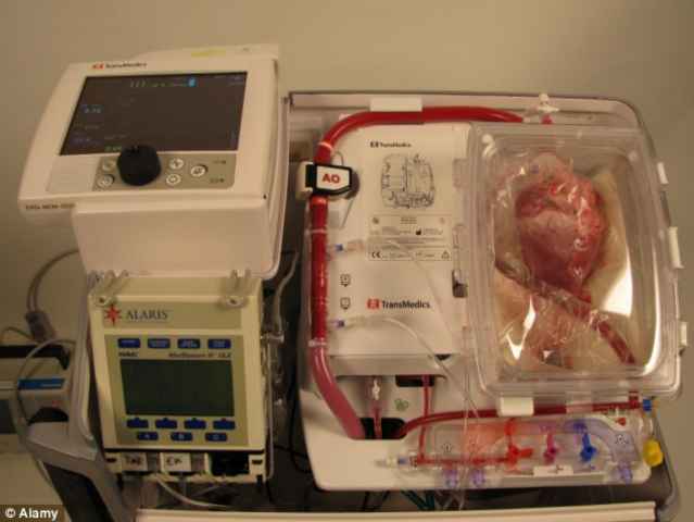 Kì diệu công nghệ giữ trái tim vẫn đập bên ngoài lồng ngực