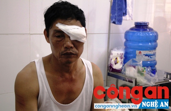Bảo vệ dân phố nhập viện vì bị đánh