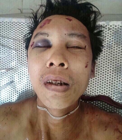 Nạn nhân trong vụ án