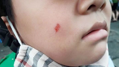 'Răn đe là phải bạo lực' hay 'lỗi là do sự nuông chiều'!?