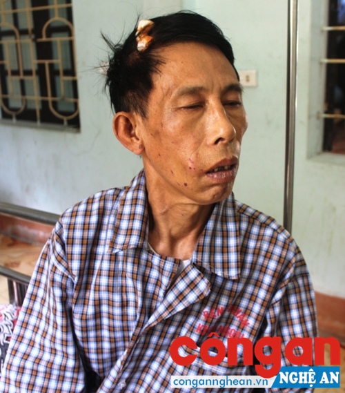 Anh Lai đang điều trị tại bệnh viện