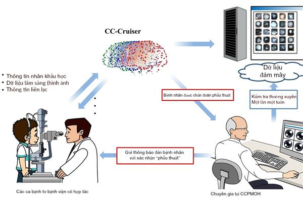 Máy chẩn đoán bệnh đục thủy tinh thể chính xác như người
