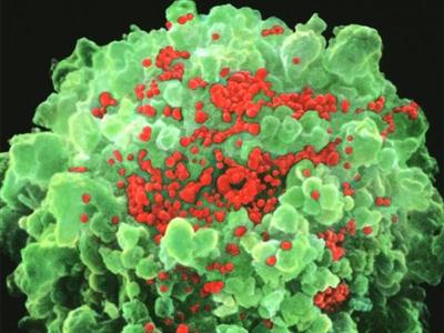 Chấn động: Vắc xin AIDS cứu 5 bệnh nhân 'sạch' HIV trong 7 tháng