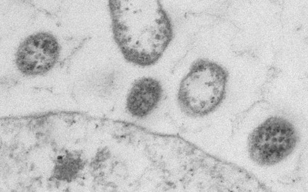 Tạo virus mới giúp cơ thể giết tế bào ung thư