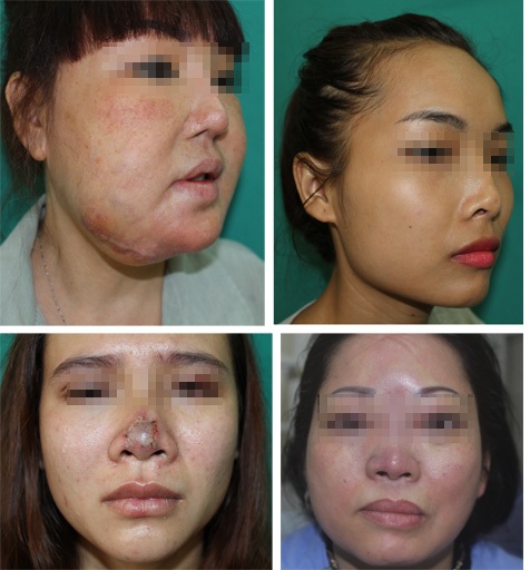 'Trùng tu' nhan sắc - những chuyện đau lòng
