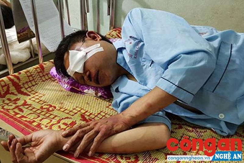 Một nạn nhân bị bắt nhầm và đánh đập vì nghi bắt cóc trẻ em phải nhập viện điều trị