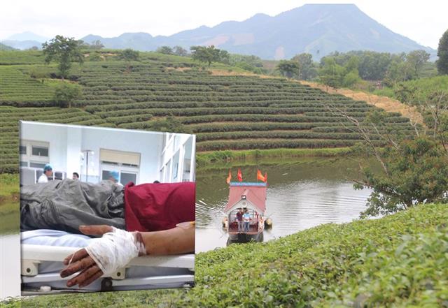 Giành chở khách ra đảo chè, chủ thuyền bị chém gần đứt lìa tay