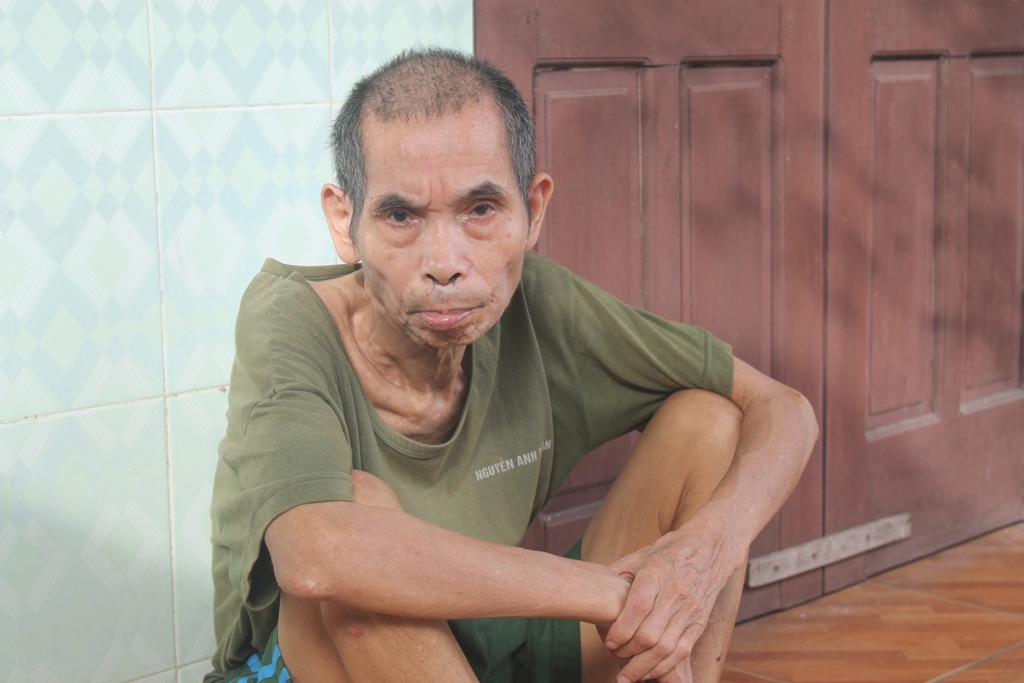 Đây đều là những thương bệnh binh mắc bệnh thần kinh, nhiều người mất hết ý thức và chăm sóc như những đứa trẻ