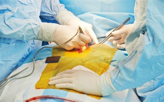 Lần đầu tiên cấy ghép thành công thực quản nhân tạo