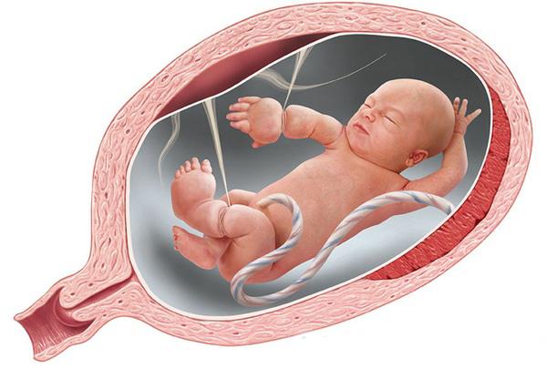 Bệnh viện Quốc tế Vinh: Phẫu thuật thành công 'Vòng thắt bẩm sinh'