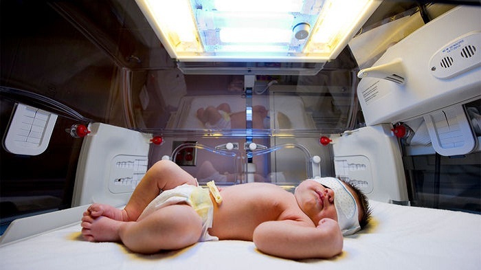 Thiết bị siêu âm giúp phát hiện tổn thương não ở trẻ nhỏ
