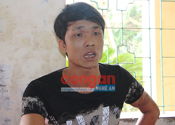 Diễn biến vụ hành hung nhân viên y tế có bầu
