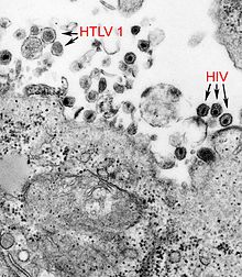 Vi-rút cổ xưa nguy hiểm hơn HIV lại trỗi dậy