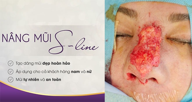 Cái kết cực đắng cho việc làm đẹp không đúng cách