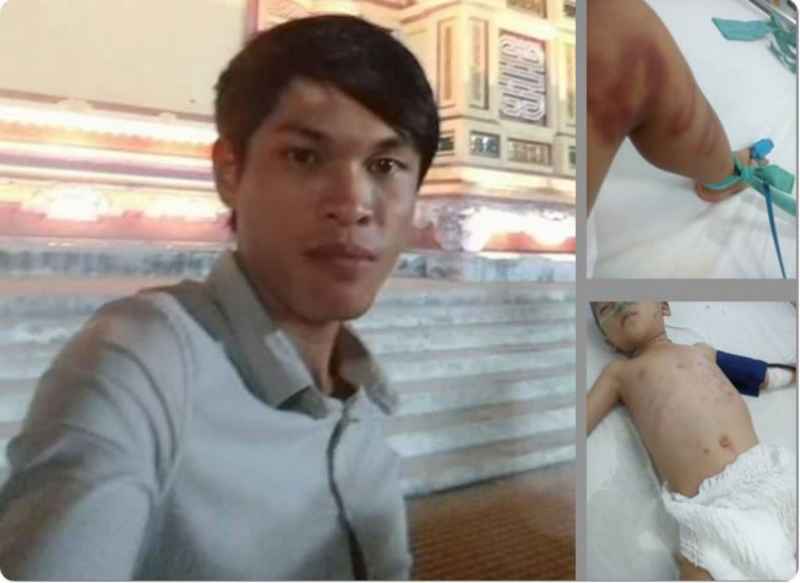 PHẪN NỘ: Cháu bé bị bạn trai của mẹ bạo hành nguy kịch