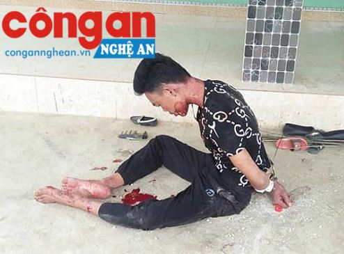 Khởi tố kẻ giết vợ rồi tự sát không thành