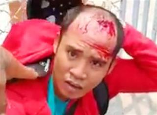 Mang kích điện chích chủ tiệm vàng, cướp 500 triệu đồng