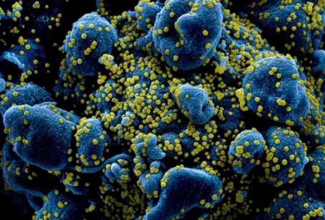 Sản xuất thành công kháng thể diệt virus corona
