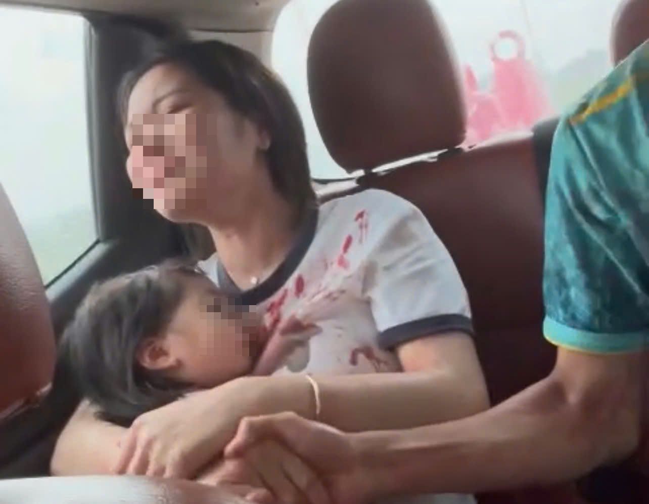 Cảnh sát giao thông dùng xe chuyên dụng đưa bệnh nhi đứt lìa ngón tay đi cấp cứu